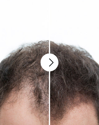 Κάψουλες κατά της τριχόπτωσης με πυκνωτική και ενισχυτική δράση Follixin 60 κάψουλες_2 - 2