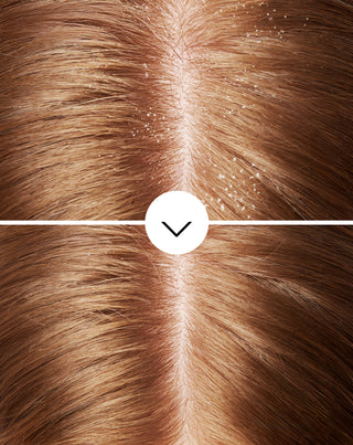 Σαμπουάν κατά της πιτυρίδας για τα μαλλιά με ολαμινική πυροκτόνη με ενυδατική δράση Nutridome - 5