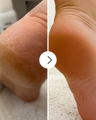 Nutridome μαλακτική κρέμα ποδιών με ουρία και βούτυρο καριτέ - 3