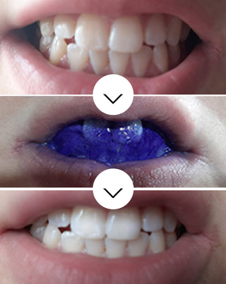 White Bite Smilebite διορθωτικός ορός για το χρώμα των δοντιών 30 ml - 3