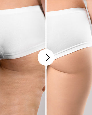 Ταμπλέτες βελτίωσης κυτταρίτιδας και δέρματος με φυσικά εκχυλίσματα Cellinea 60 κάψουλες - 4