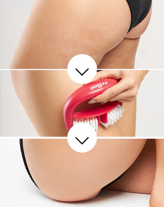 Αντι-κυτταριτιδικό μασάζ με καρτέλες καταπολεμά την κυτταρίτιδα και μειώνει τη μυϊκή ένταση Crush my Celloo - 3