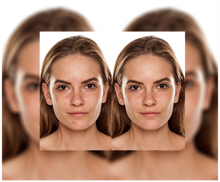 Ταμπλέτες για ακμή, σπυράκια και ατέλειες με ψευδάργυρο, βιταμίνη C, E και B2 Derminax - 6