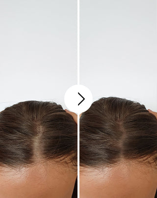 Κάψουλες κατά της τριχόπτωσης με πυκνωτική και ενισχυτική δράση Follixin 60 κάψουλες_4 - 4